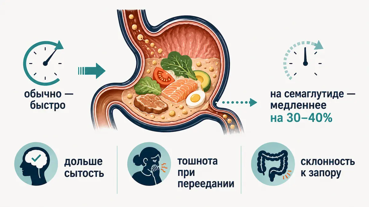 Замедленное опорожнение желудка на семаглутиде Как семаглутид замедляет опорожнение желудка — схема механизма